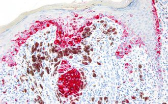 BOND Polymer Refine Red Detection product photo