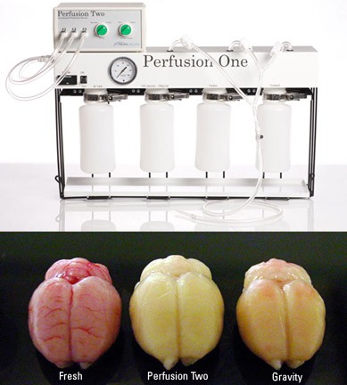 Perfusion Two™ Automated Perfusion Inst. photo produit Front View L