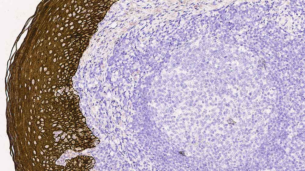 Cytokeratin, Multi (4/5/6/8/10/13/18) - IHC Primary Antibodies