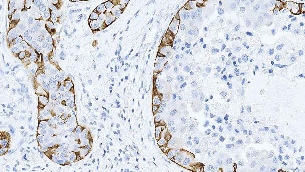 细胞角蛋白5 产品照片 Front View S
