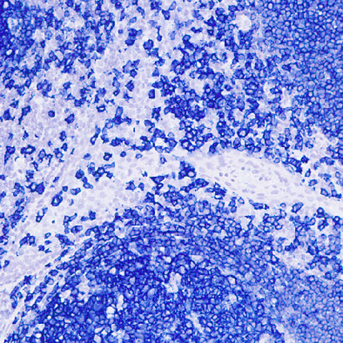 Blue Chromogen Produktfoto Front View L
