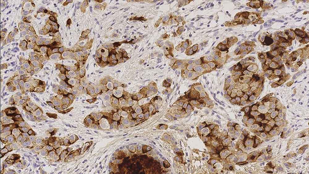 Gross Cystic Disease Fluid Protein-15 photo produit Front View L