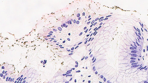 Helicobacter pylori Produktfoto Front View S