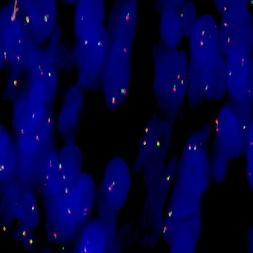 IVD MYC (8q24) Break - XL for BOND - ISH Probes - Molecular Pathology