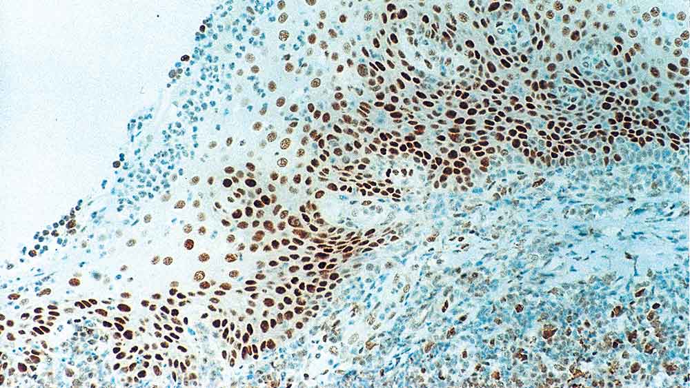 Retinoblastoma Gene Protein product photo Front View S