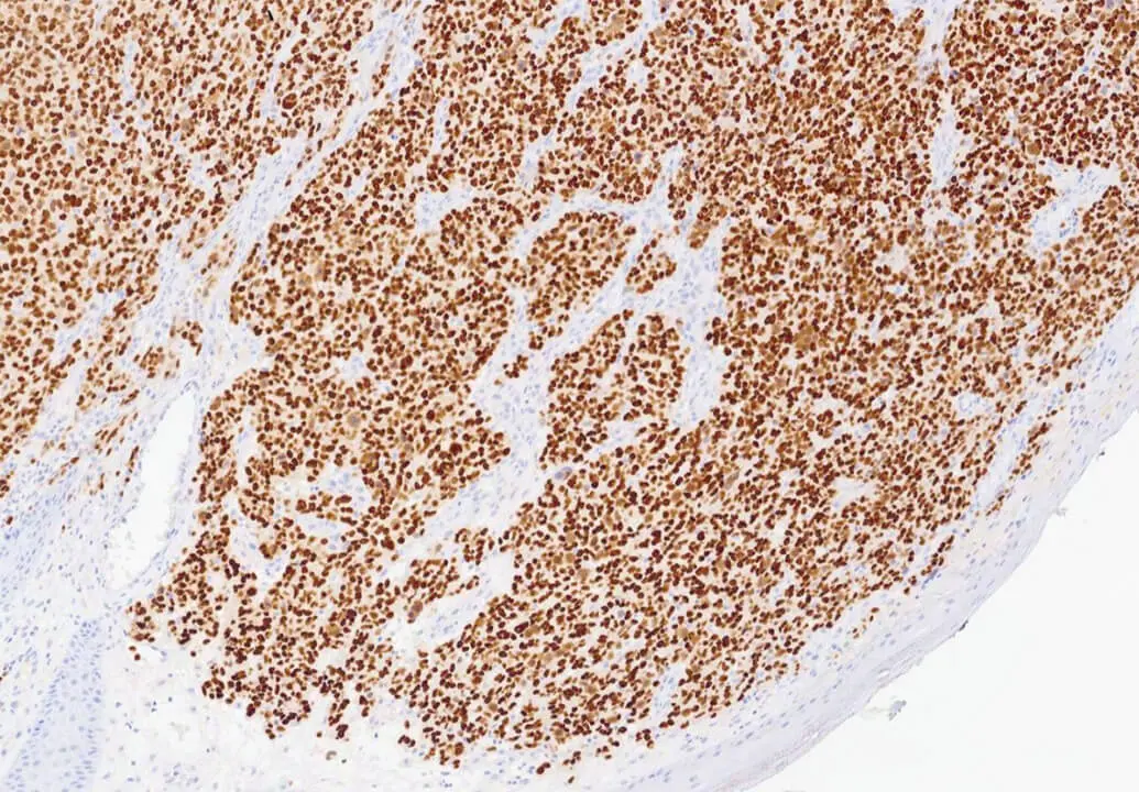 SOX-10 - IHC Primary Antibodies product photo Side View S