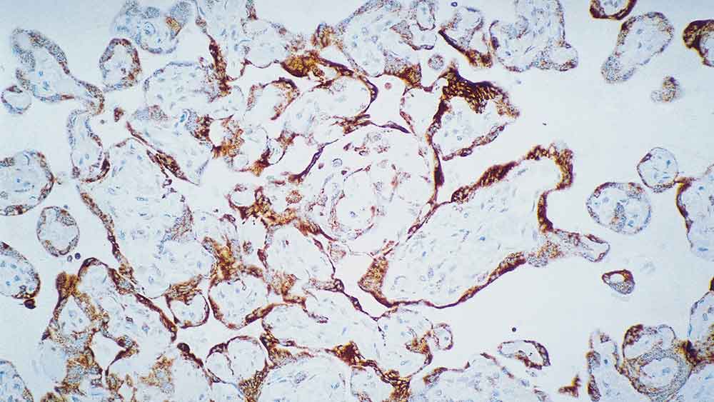 Vascular Endothelial Growth Factor Receptor-3 製品画像 Front View L