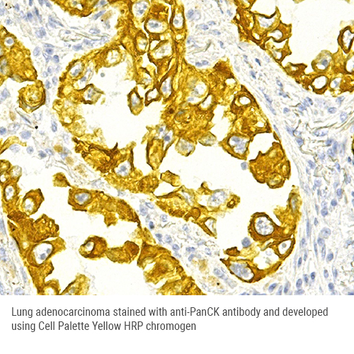 Cell Palette Yellow HRP Chromogen Kit photo produit Side View S