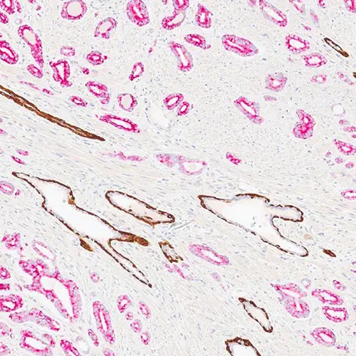 ChromoPlex 1 Dual Detection for BOND product photo Back View S