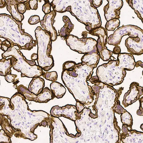 Epidermal Growth Factor Receptor Produktfoto Front View S