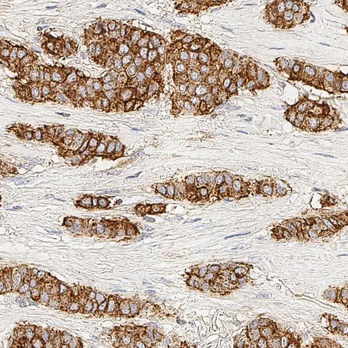 Epithelial Membrane Antigen product photo Front View S