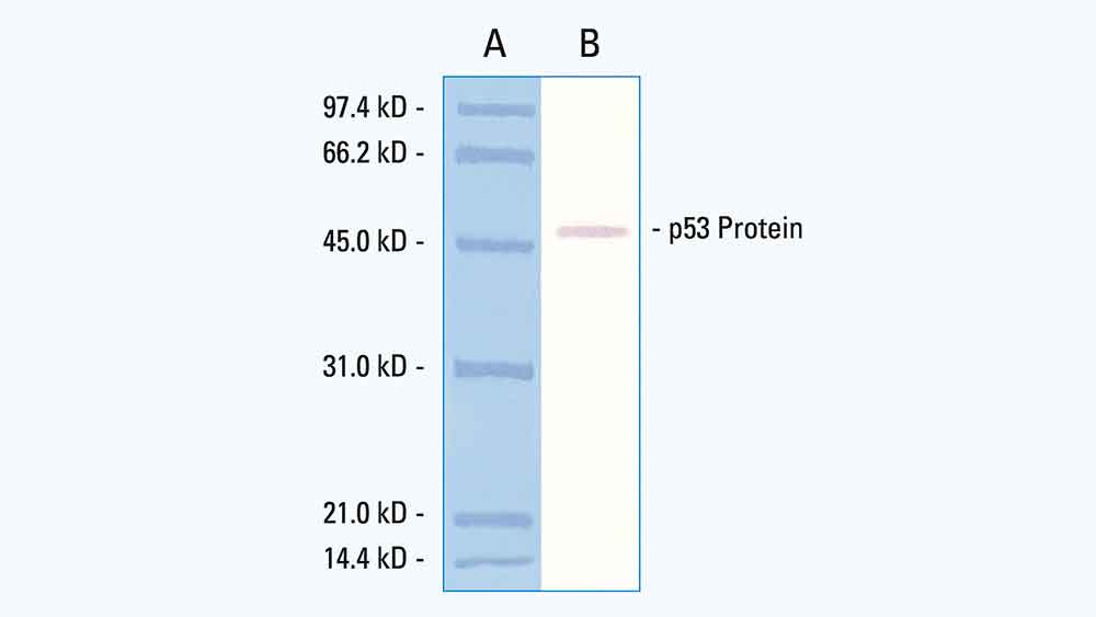 p53 Protein (CM5) 製品画像 Front View L