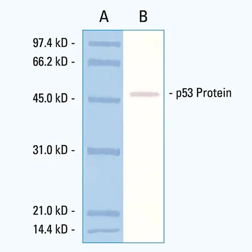 p53 Protein (CM5) Produktfoto Front View S